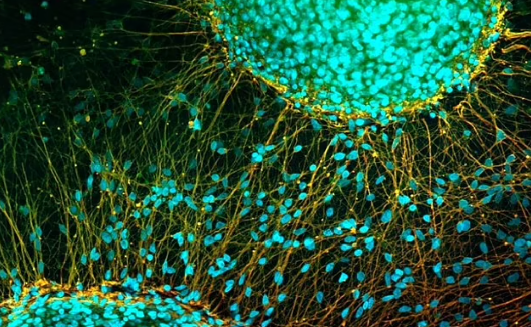 علاج «شلل النخاع الشوكي»