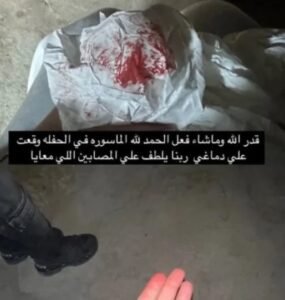 إلغاء حفل تامر حسني بعد إصابة 20 شخص
