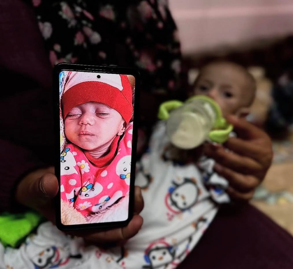 «سوار عاشور» مأساة طفلة فلسطينية