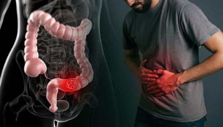 تحذير من عادات غذائية شائعة تزيد خطر الإمساك الصباحي