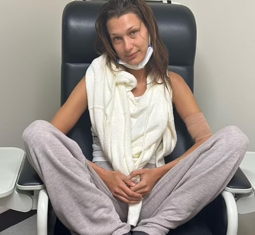 مرض لايم.. لماذا يُصيب الأغنياء والمشاهير