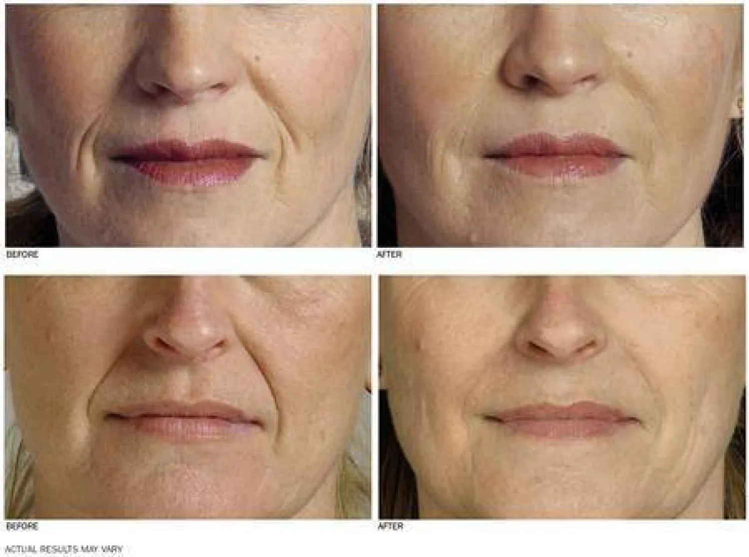 الكولاجين: السر الجمالي الذي يتراجع بعد سن الـ25