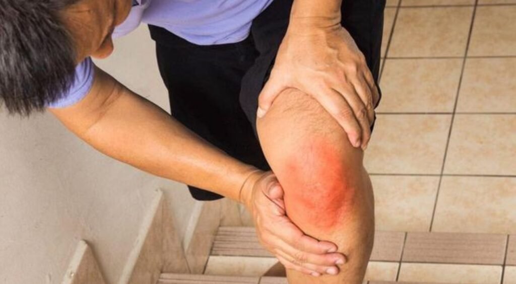 العلاج الأقوى لآلام المفاصل دون أدوية أو جراحة