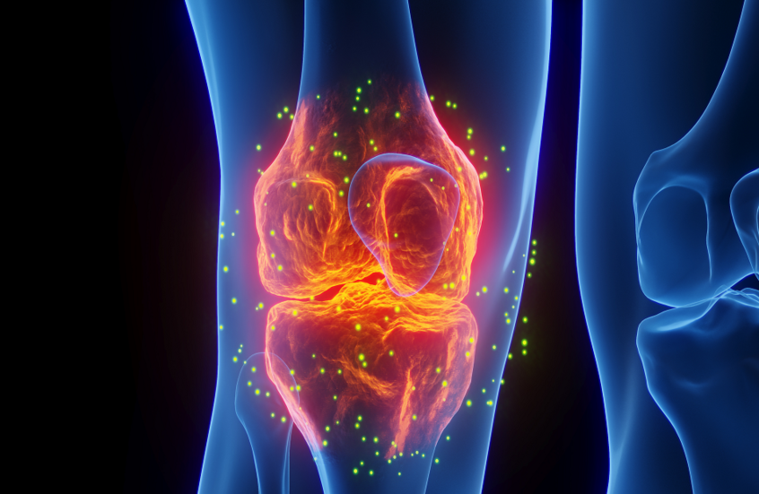 اكتشاف علمي يفتح آفاقًا جديدة لعلاج هشاشة العظام