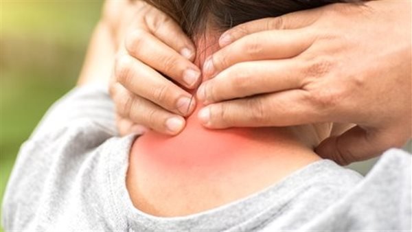 تشنج الرقبة.. سبب خفي وراء الصداع النصفي وفق أخصائي أعصاب