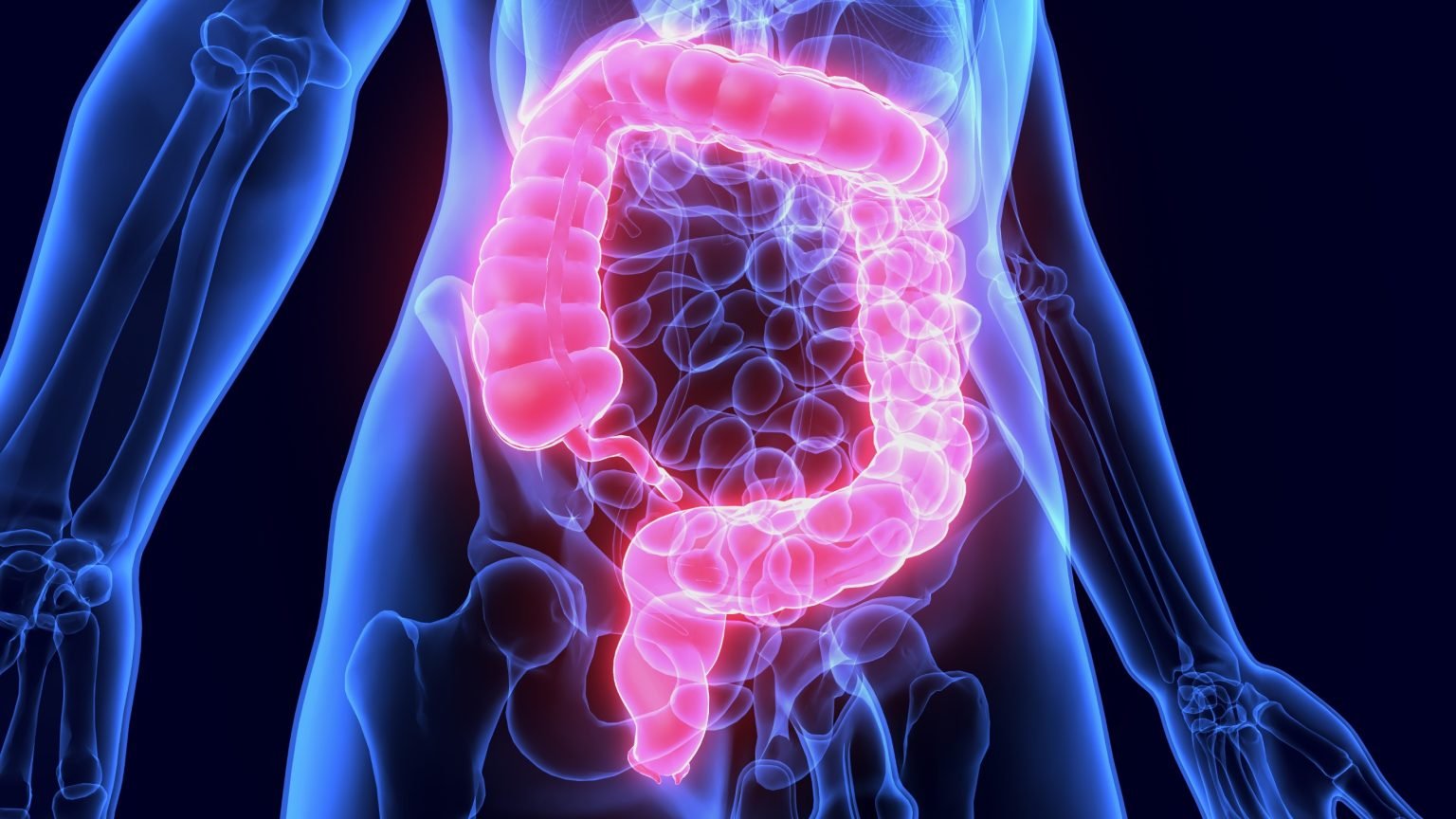 دراسة: تغيّرات صامتة في القولون قد تفسّر ارتفاع سرطان الشباب