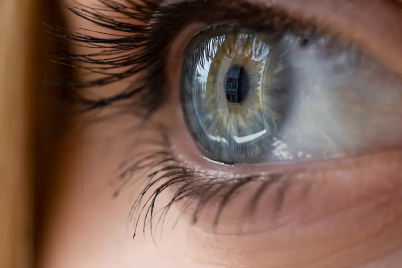 دراسة تحذّر من مرهم عيون شائع قد يُتلف زرعات علاج الغلوكوما