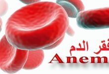 هل يستطيع مريض فقر الدم الصيام في رمضان؟