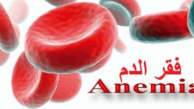 هل يستطيع مريض فقر الدم الصيام في رمضان؟