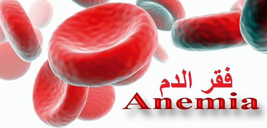 هل يستطيع مريض فقر الدم الصيام في رمضان؟