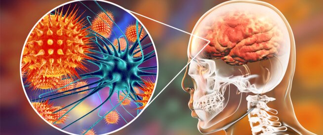 قلق في بريطانيا بعد تسجيل إصابات بالتهاب السحايا ونقص في اللقاحات